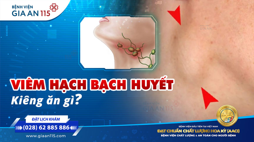 Viêm hạch bạch huyết kiêng ăn gì