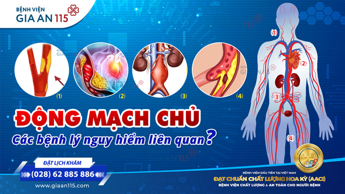 Động mạch chủ là gì