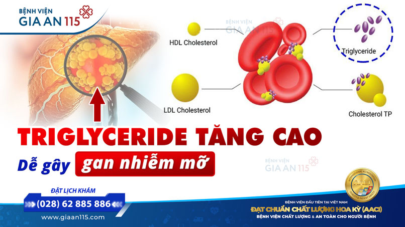 Triglyceride tăng cao - Dễ gây gan nhiễm mỡ