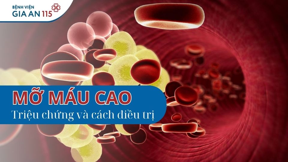 Mỡ trong máu cao: Nguyên nhân, triệu chứng và cách điều trị