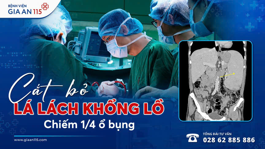 Cắt bỏ lá lách khổng lồ chiếm 1/4 ổ bụng của cụ ông gần 80 tuổi
