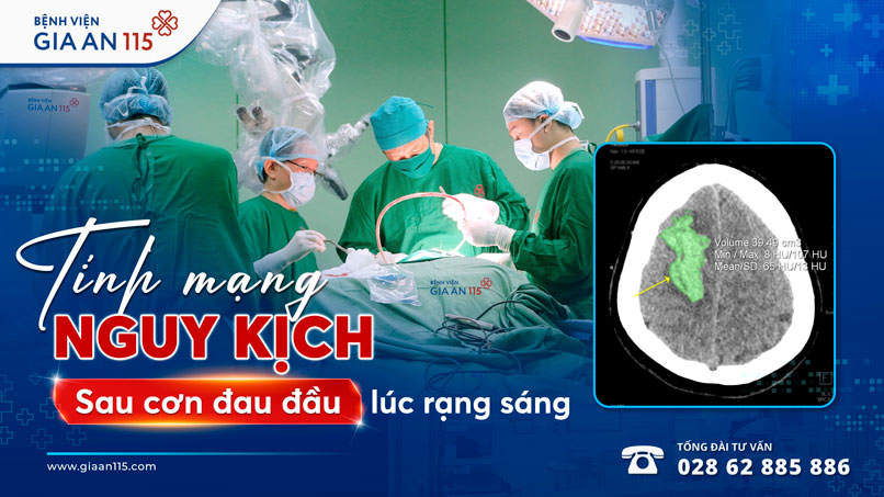 Cô gái 26 tuổi suýt tử vong sau cơn đau đầu lúc rạng sáng