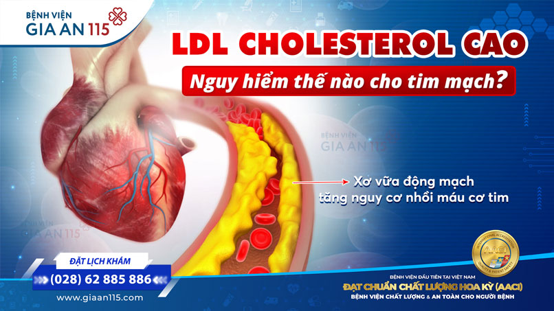 LDL-C cao nguy hiểm thế nào cho tim mạch