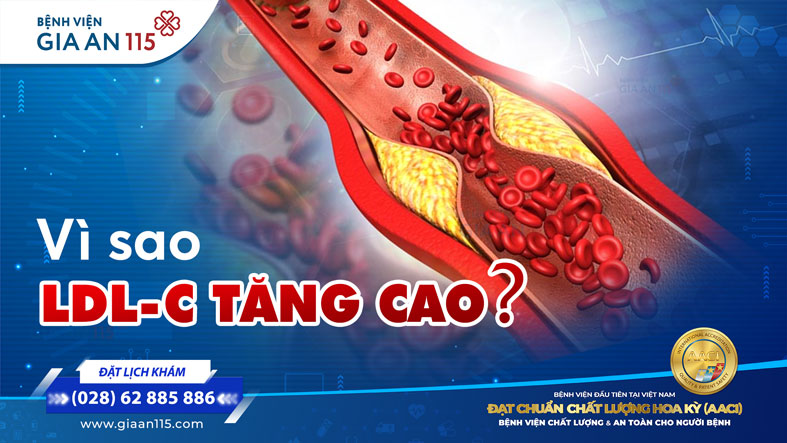 LDL-C cao Nguy hiểm thế nào cho tim mạch
