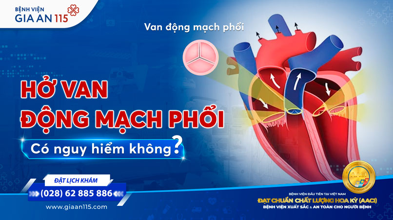 Hở van động mạch phổi có nguy hiểm không?