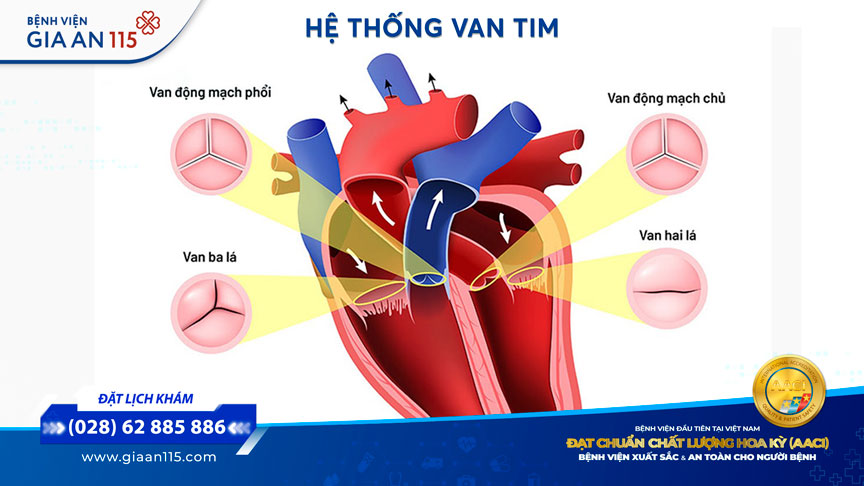 Hở van động mạch phổi có nguy hiểm không