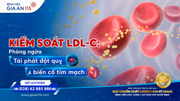 Kiểm soát LDL-C Chìa khóa phòng ngừa tái phát đột quỵ và biến cố tim mạch