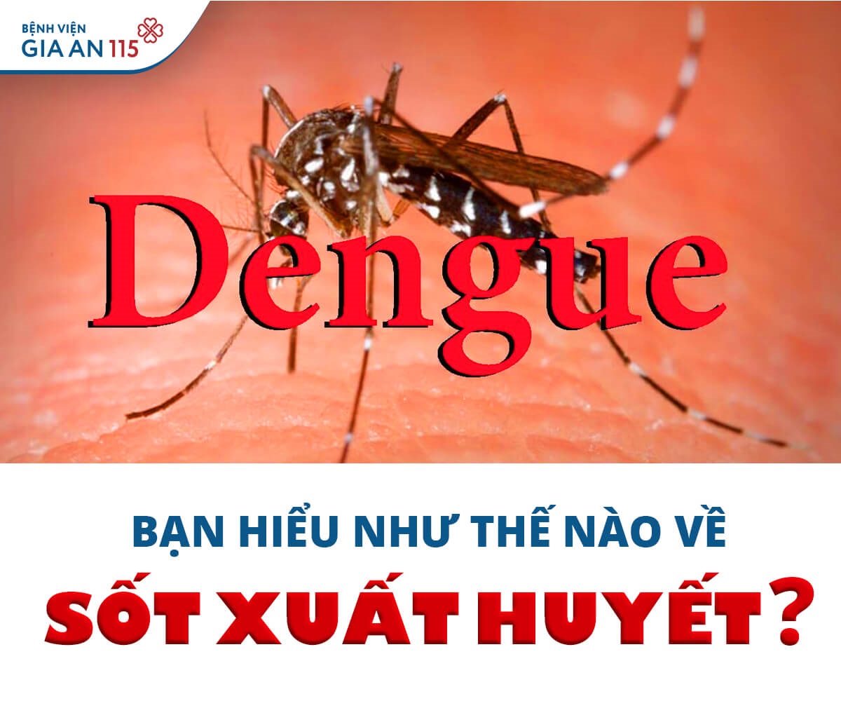 Bệnh sốt xuất huyết Dengue là gì?