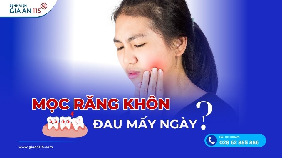 Mọc răng khôn đau mấy ngày