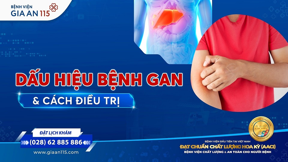 Bệnh gan: Dấu hiệu cảnh báo và các phương pháp điều trị