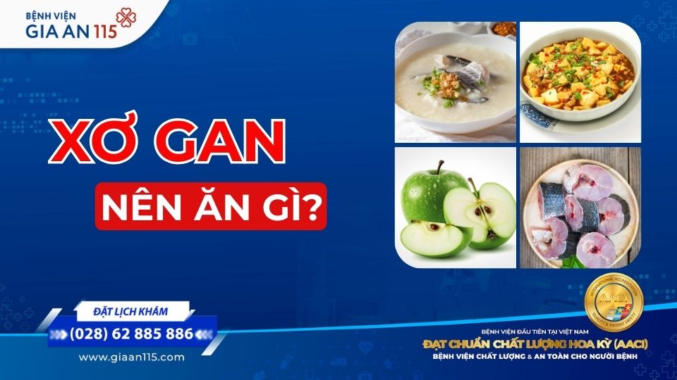 Những món ăn tốt cho người bị xơ gan