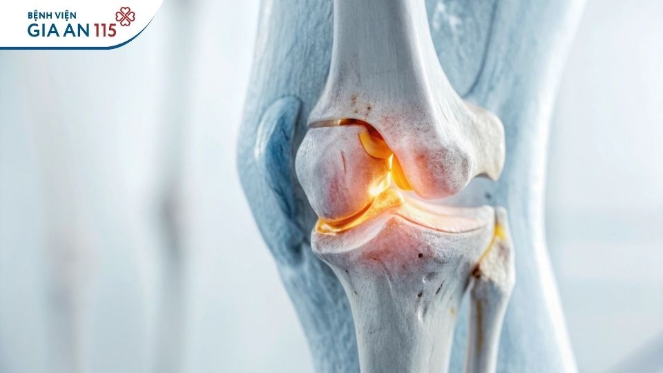 Tiêm huyết tương giàu tiểu cầu nhiều có tốt không