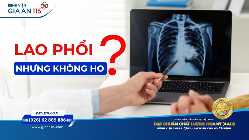 Bị lao phổi nhưng không ho