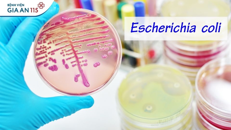 Uống nước máy trực tiếp An toàn hay tiềm ẩn rủi ro