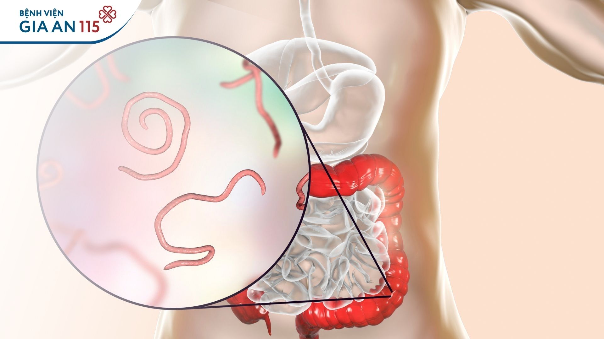 Bị ngứa hậu môn vào ban đêm 