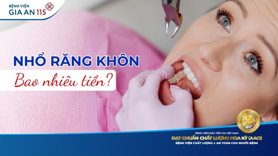 Chi phí nhổ răng khôn có bảo hiểm y tế hết bao nhiêu? 