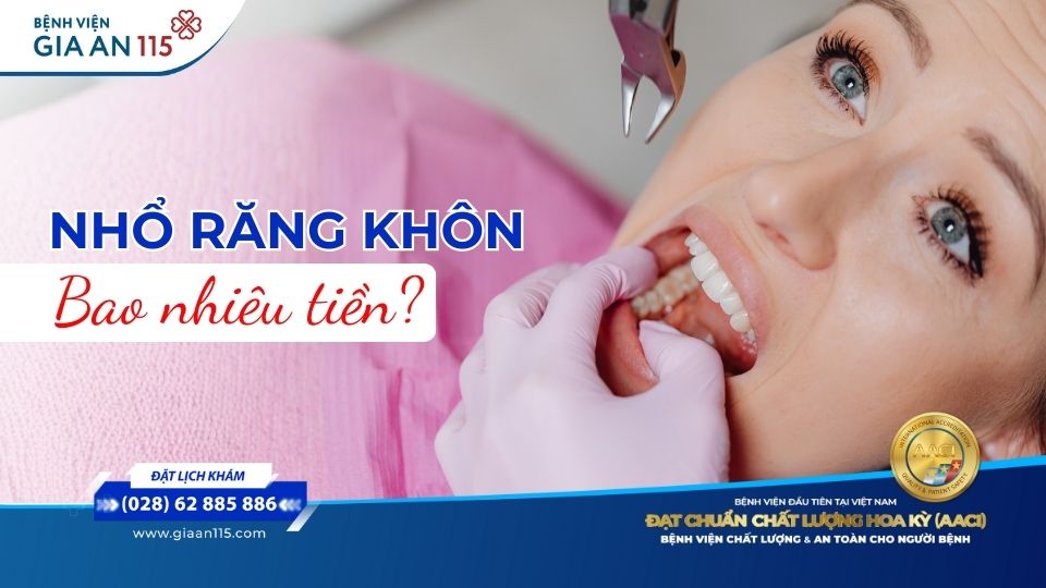 Chi phí nhổ răng khôn có bảo hiểm y tế hết bao nhiêu? 