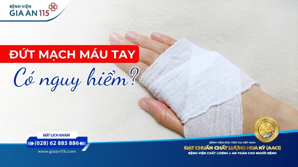 Đứt mạch máu ở tay có nguy hiểm không