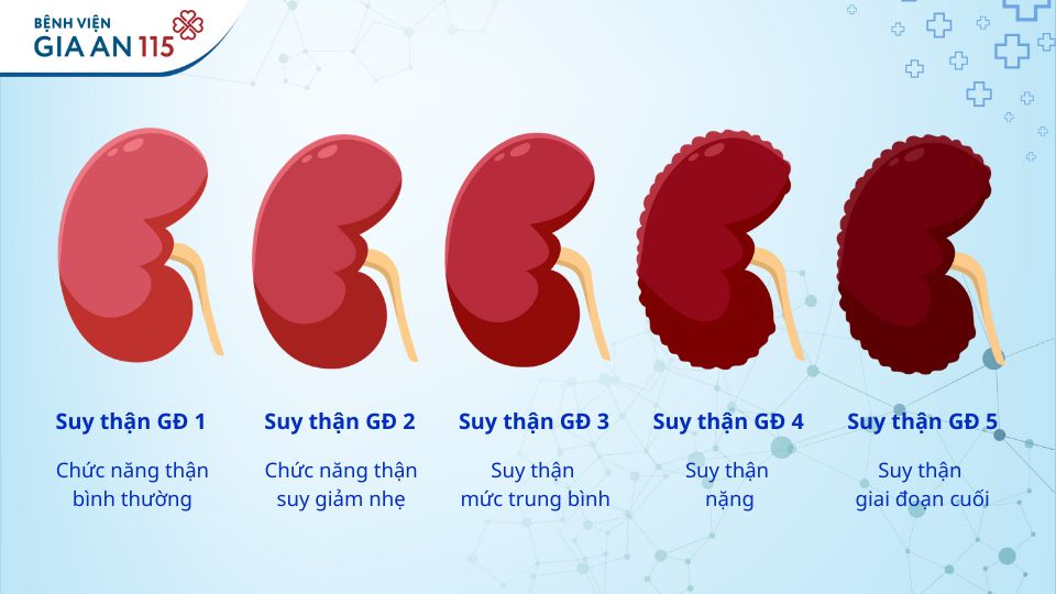 Phân độ bệnh thận mạn