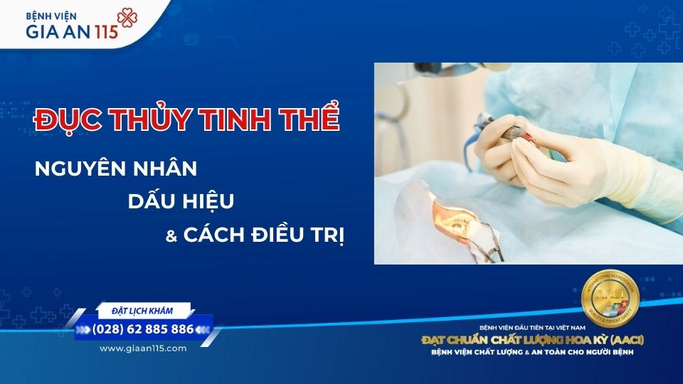 Đục thủy tinh thể