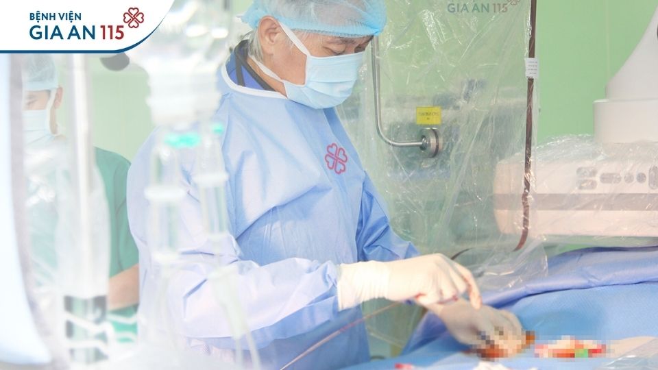 Đi khám vì thỉnh thoảng đau ngực, được phát hiện mạch máu tim hẹp nặng đến 99%