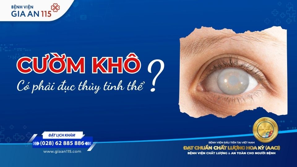 Cườm khô là gì