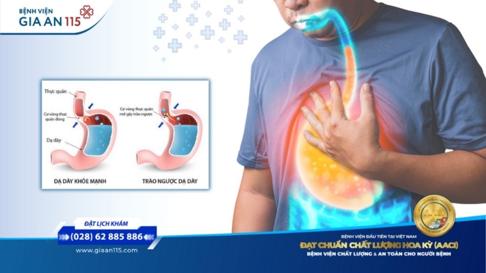 Bị đau bụng trên rốn sau khi ăn 