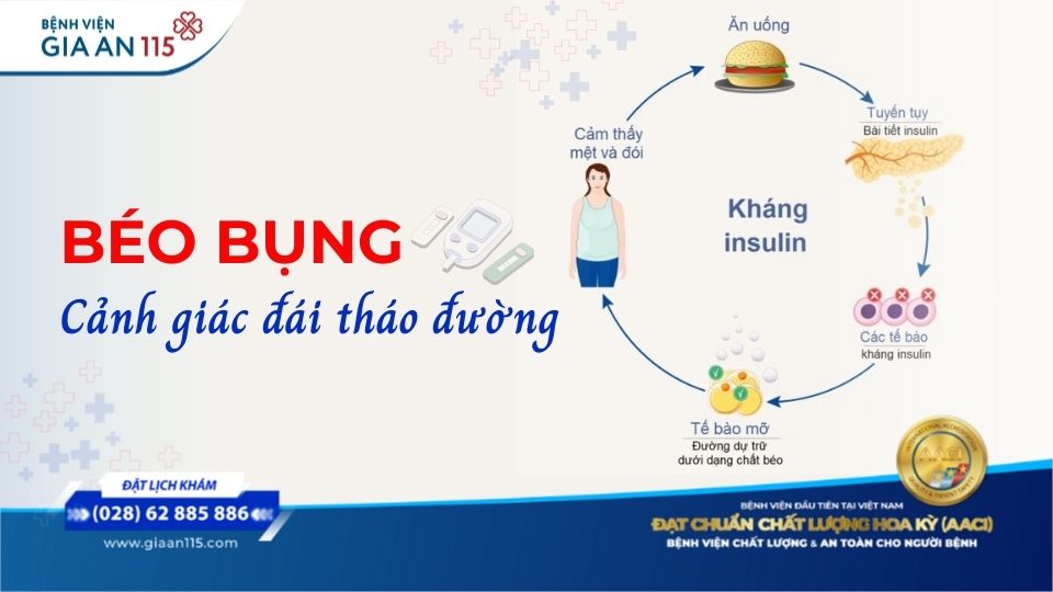 Béo bụng: Cảnh giác đái tháo đường type 2