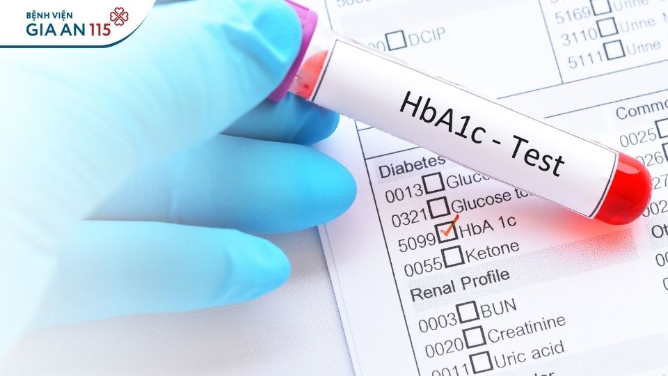 Béo bụng: Cảnh giác đái tháo đường type 2