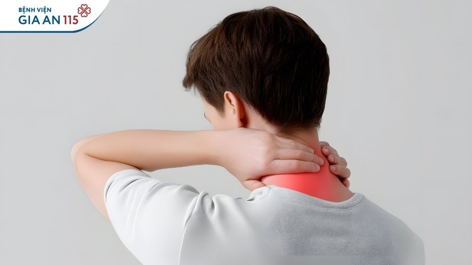 Đau mỏi cổ vai gáy: Có nên dùng cao dán, dầu nóng