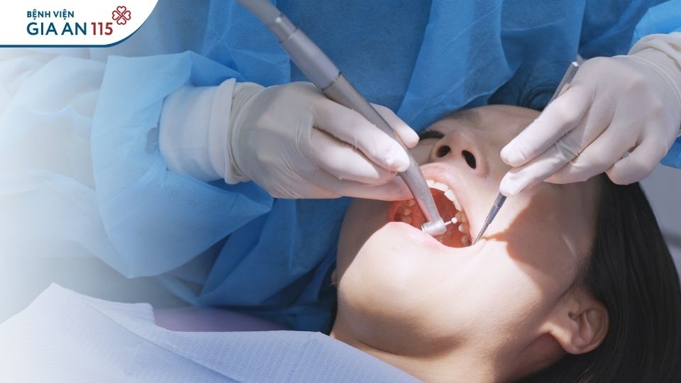 Dùng thạch tín trong nha khoa có thể gây biến chứng gì?