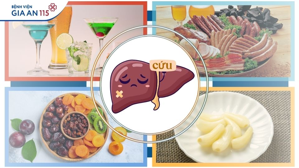 Món ngon ngày Tết: Ăn sao để không gây “quá tải” cho gan, thận?