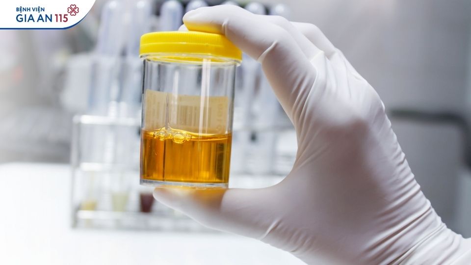 Uống ít nước – Thói quen âm thầm hủy hoại thận