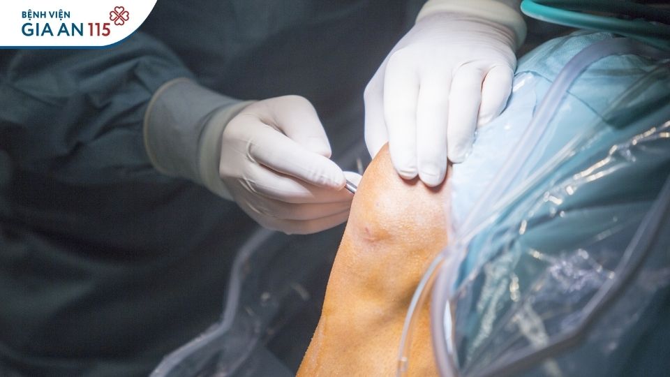 Thay khớp gối nhân tạo có đau không