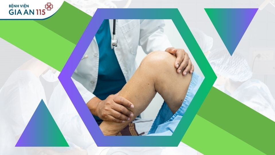 Thay khớp gối nhân tạo có đau không