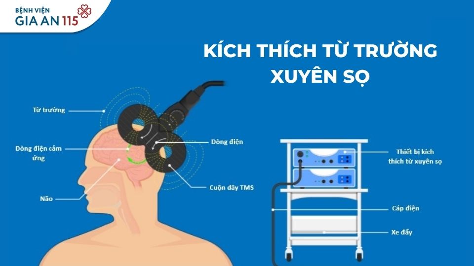 kích thích từ trường xuyên sọ