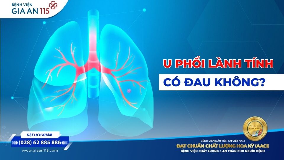 U phổi lành tính có đau không?