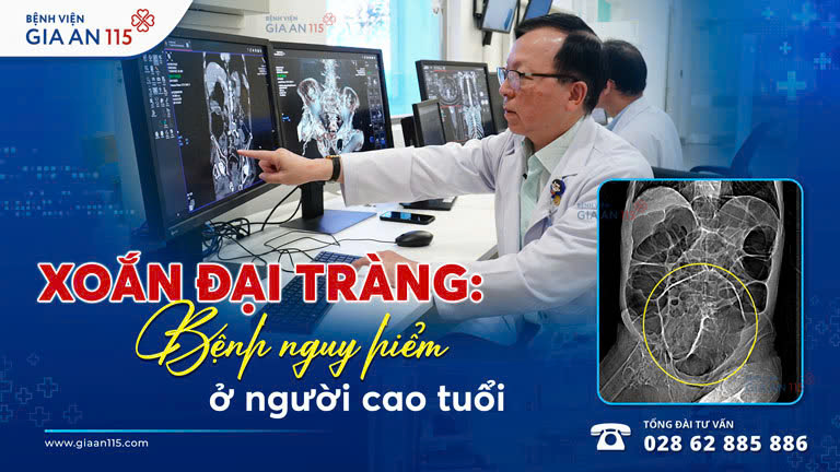 Xoắn đại tràng: Bệnh nguy hiểm ở người cao tuổi