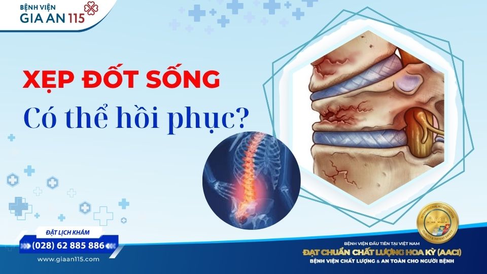 Xẹp đốt sống có hồi phục được không