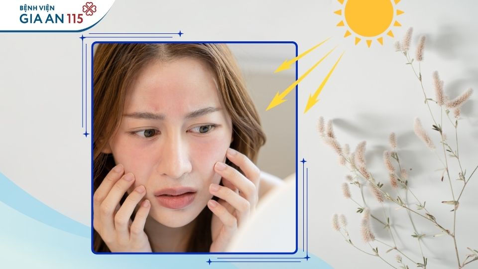 Kem dưỡng da “thần tốc”: Bác sĩ da liễu cảnh báo nguy cơ tổn thương da nghiêm trọng