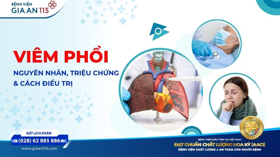 Viêm phổi: Nguyên nhân, dấu hiệu, cách điều trị và phòng ngừa