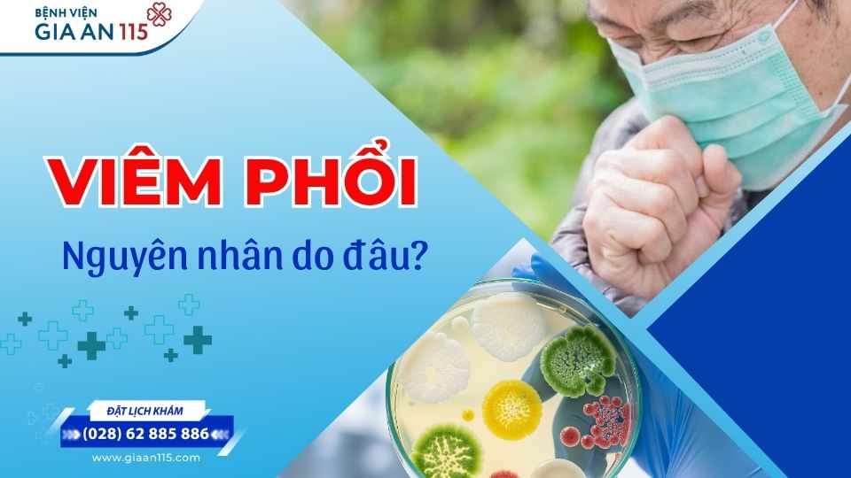 Nguyên nhân viêm phổi thường gặp ở người lớn và người cao tuổi
