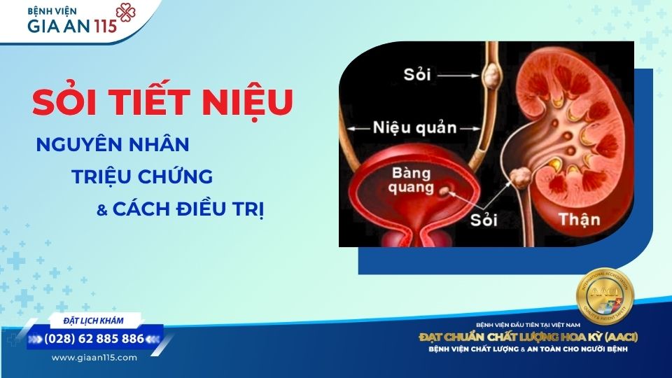 Sỏi tiết niệu: Nguyên nhân, triệu chứng, chẩn đoán và các phương pháp điều trị hiện nay