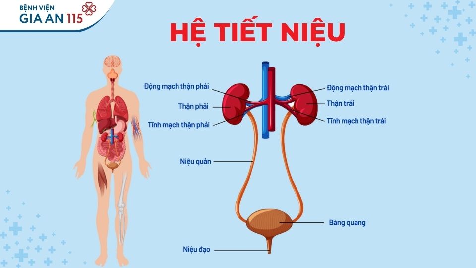 Sỏi tiết niệu