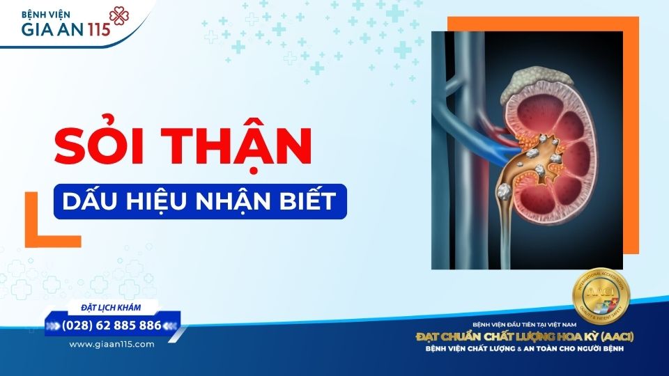 Dấu hiệu sỏi thận