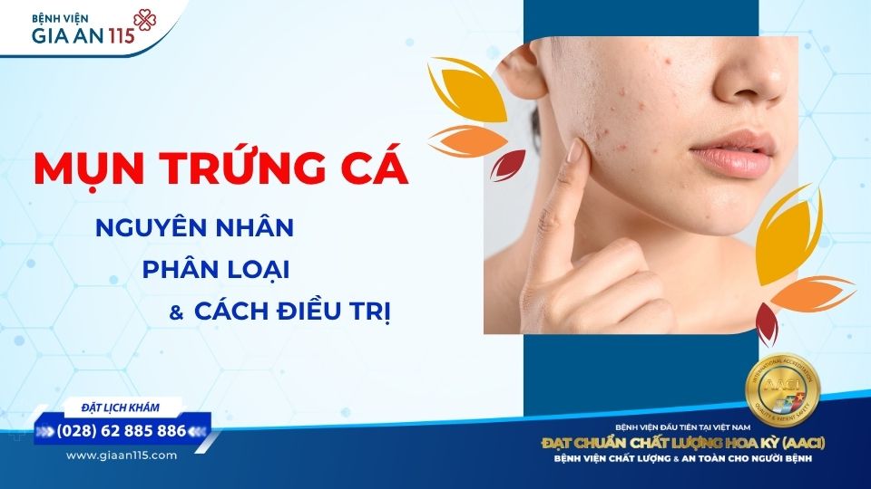 Mụn trứng cá
