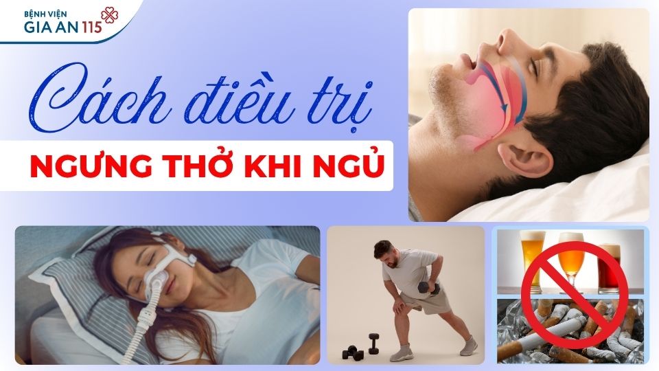 Điều trị hội chứng ngưng thở khi ngủ