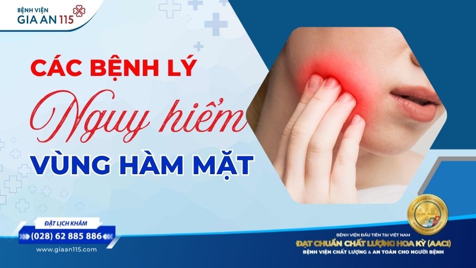 Đau răng, sưng mặt kéo dài: Có thể cảnh báo bệnh nguy hiểm