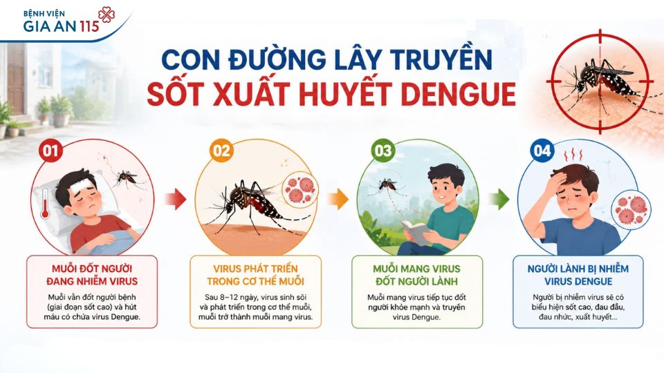 Sốt xuất huyết Dengue