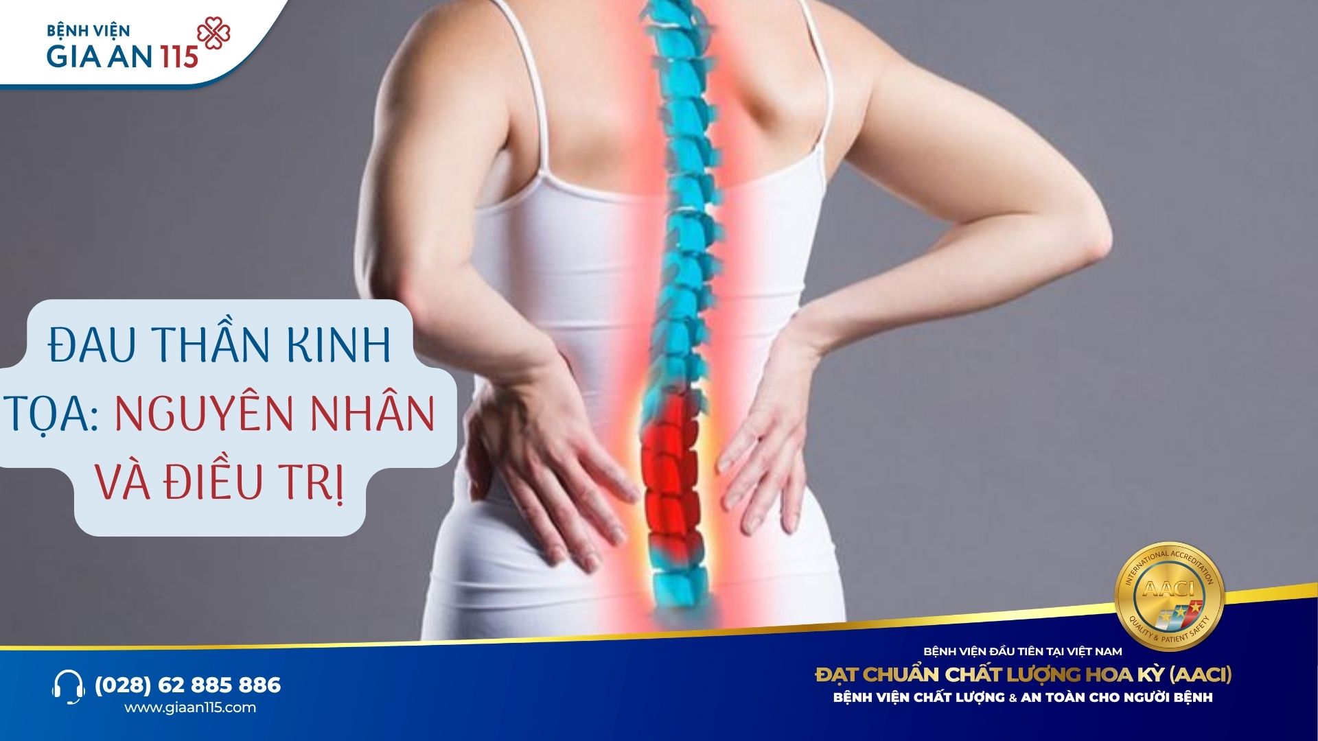 Đau thần kinh tọa: Nguyên nhân, triệu chứng và phương pháp điều trị hiệu quả